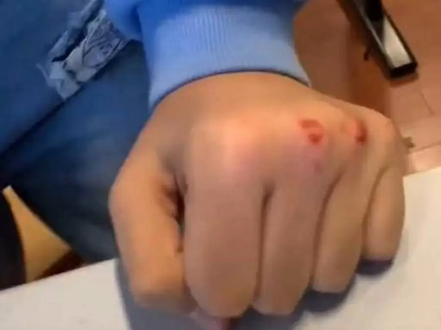 tik-tok-challenge-scuola-mani-sangue-campania-napoli