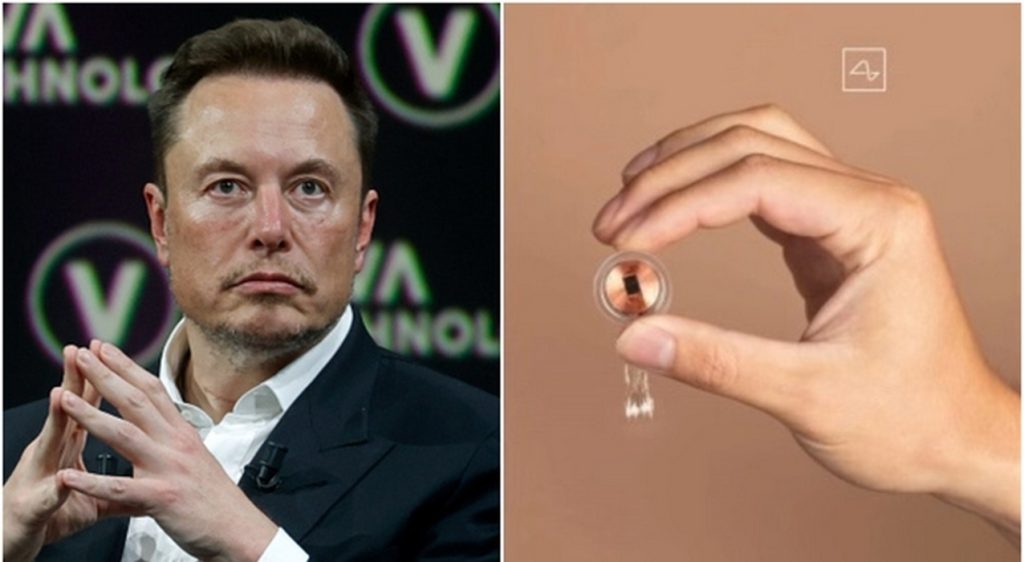 elon musk neuralink primo impianto cerebrale essere umano cos'è come funziona